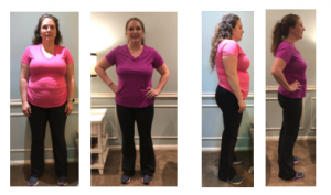 Stephanie G Before & Afters 11.2018